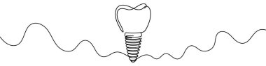 Beyaz arka planda izole edilmiş sürekli bir diş implantı çizimi. Diş implantı çizgisi