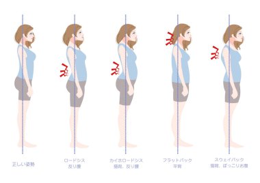 Yan tarafından görülen kötü duruşu olan bir kadın.