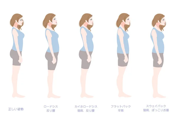 Clip Art Set Woman Bad Posture Seen Side — Stock Vector