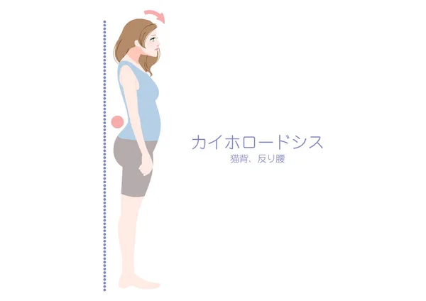 Ilustración Una Mujer Postura Quihorosis Vista Desde Costado — Vector de stock
