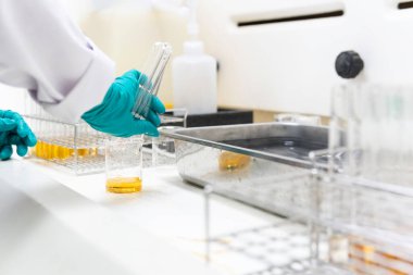 Kimyagerler laboratuvarda antiretroviral ilaçlar bulmak için kimyasalları karıştırdılar, kanda virüsü tespit etmek için deneyler yapıldı, COVID-19 'a karşı potansiyel ilaç ve aşı geliştiricileri bulundu.