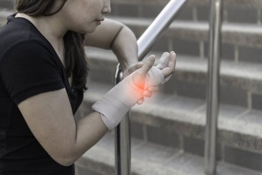 Güzel bir Asyalı kız kolunu kırdı ve sabitledi. Kadın kazara düşmüş, kollar yere çarpmış, kırıklar oluşmuş.,