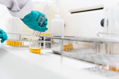 Kimyagerler laboratuvarda antiretroviral ilaçlar bulmak için kimyasalları karıştırdılar, kanda virüsü tespit etmek için deneyler yapıldı, COVID-19 'a karşı potansiyel ilaç ve aşı geliştiricileri bulundu.