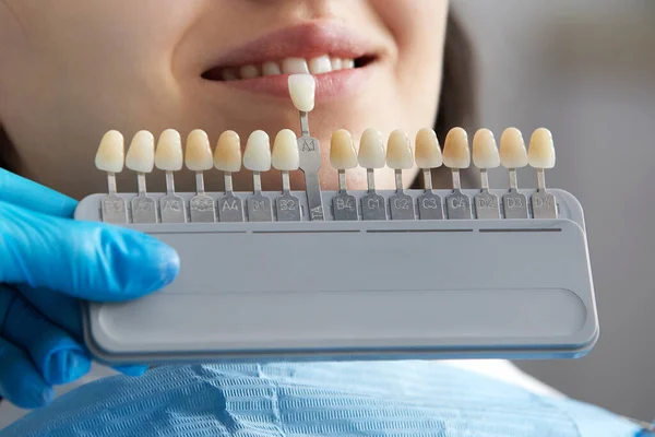 Dentist choosing color of tooth enamel for patient. Dentist applying sample from tooth enamel scale to caucasian female patient teeth