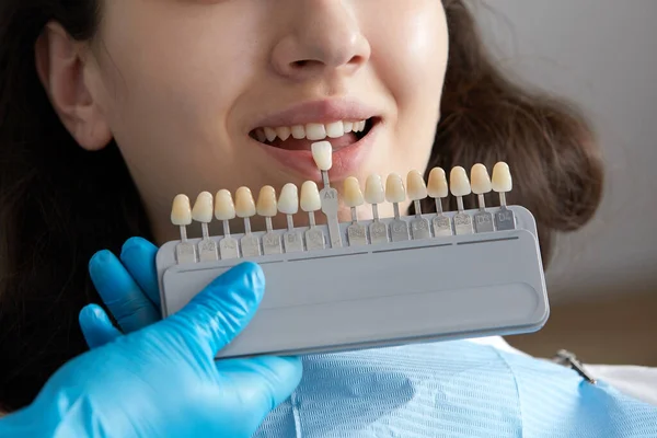 Dentist choosing color of tooth enamel for patient. Dentist applying sample from tooth enamel scale to caucasian female patient teeth