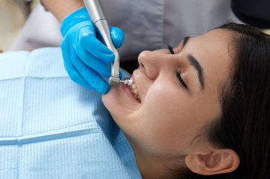 Modern diş kliniğinde dişlerini cilalatan genç bir kadın.