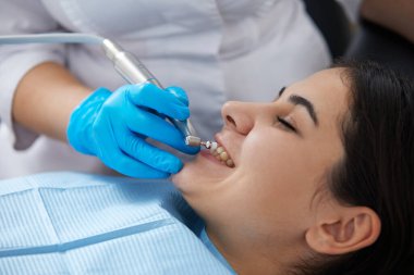 Young woman getting her teeth polished in modern dental clinic