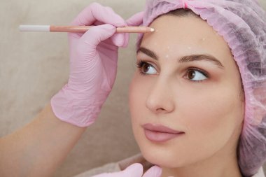 Kozmetik uzmanı, gençleştirme tedavisine hazırlanmak için hasta yüzüne işaret çiziyor.