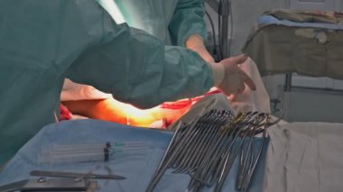 Yaralı bir bacak ameliyat odasında bir doktor tarafından dikişle tedavi edilir.
