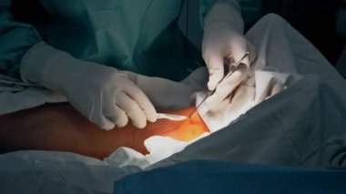 Ameliyat odasındaki doktorların yaralı bir bacağı dikmesi alışılmadık bir şey değil.