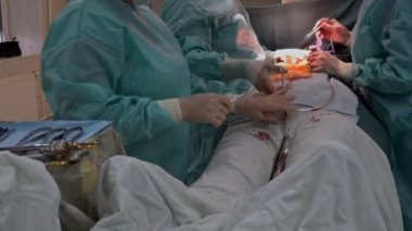 Koroner arter baypas grevlerinin kalp ameliyatlarının bir parçası olarak gerçekleştirildiği hastanedeki bir ameliyat odasıdır.