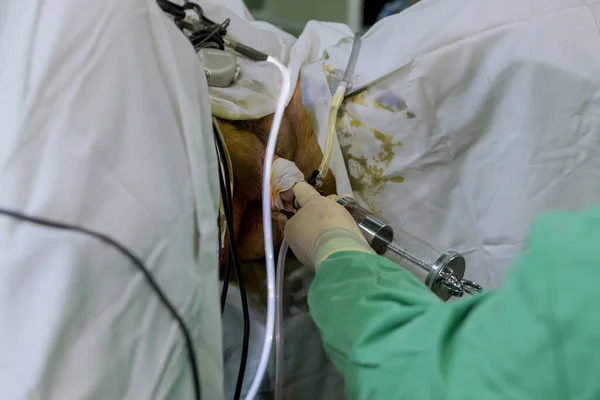 Tijdens Turp Procedure Resectoscoop Wordt Ingevoerd Urethra Overtollig Prostaatweefsel Verwijderen — Stockfoto