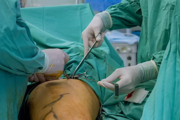 医生的腿手术是在受伤后进行的整形手术 — 图库照片