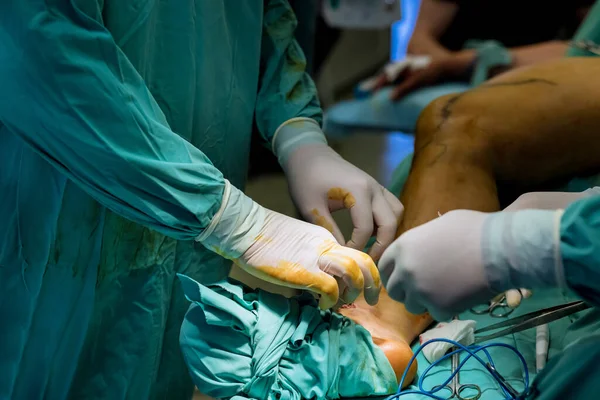 Ortopedik Cerrahlar Çeşitli Yaraları Tedavi Etmek Için Bacakları Ameliyat Etmede — Stok fotoğraf