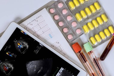 Doktor, elektrokardiyogram EKG gramındaki hastanın kalp aktivitesini kontrol etmek için dijital tablet kullanıyor..