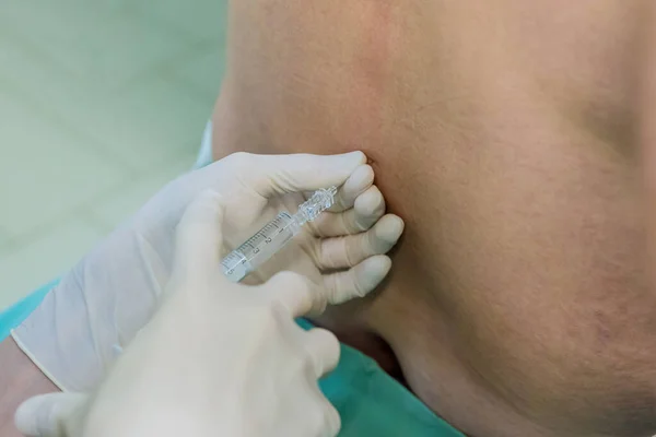 stock image Surgical room lumbar spinal puncture procedures for collecting samples in patient