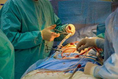 Ameliyat sırasında ameliyathanedeki hastaya açık kalp ameliyatı