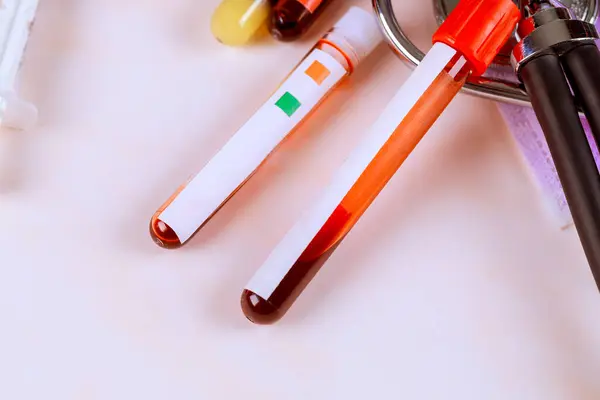 Stock image Medical tube containing blood sample for examination in laboratory