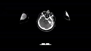 Detaylı kesit insan beyni anatomisini gösteriyor, CT taraması sırasında kafatası özellikleri.