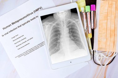 Medical document outlines human metapneumovirus alongside chest x ray, blood samples test tubes in healthcare setting. clipart