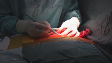 Tıbbi profesyoneller hassas prosedürleri parlak ameliyathane ışıkları altında gerçekleştirir..