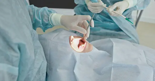 stock image Dental Surgery in Progress: Oral Cavity Operation. High quality 4k footage