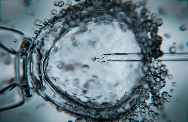 Vitro Fertilization Intracytoplasmic Sperm Injection Illustration — Stock Photo, Image
