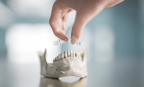 Woman Putting Transparent Orthodontic Aligner Cast Teeth Using Her Hand — Stock Photo, Image