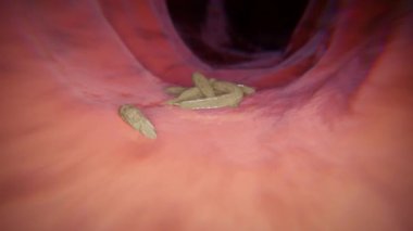 Gastroskop keşfi - incelemeler sırasında bakteri tespitinin görüntülenmesi