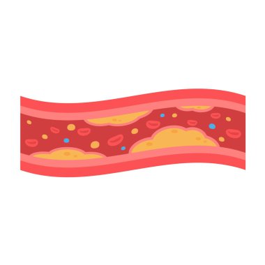 coronary arteries with accumulated fat in the body clipart