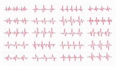 Kalp ritmi grafiği kalp atışlarını kontrol ediyor.