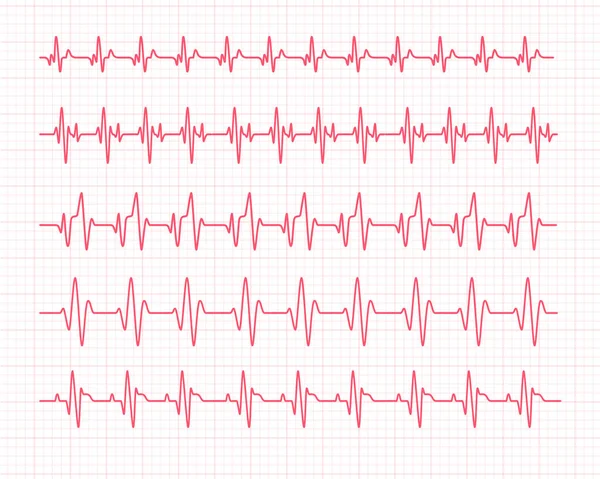 Gráfico Del Ritmo Cardíaco Comprobación Los Latidos Del Corazón Para — Vector de stock