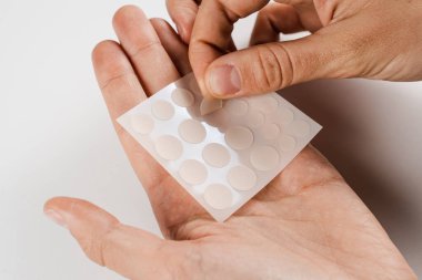 Sivilce ve rosacea tedavisi için sivilce bandı alan bir kız. Yüz tazeleme, kozmetolojiyi temizleme. Sivilceler için beyaz arkaplanda yuvarlak yamalar