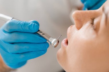 Diş matkabı yakın plan. Diş hekimliği kliniğinde dişçilik yapan bir kadın. Diş tedavisi. Kız hastalar için diş dolgusu