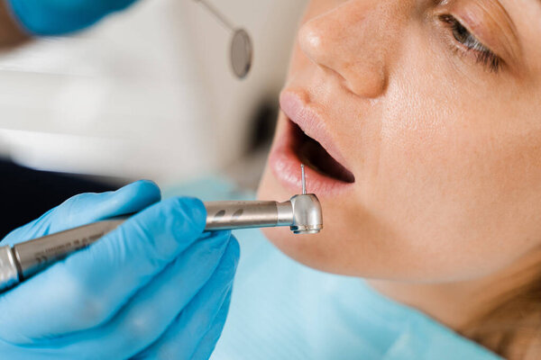 Dental drill close-up. Dentist drilling teeth of woman in dentistry clinic. Teeth treatment. Dental filling for girl patient