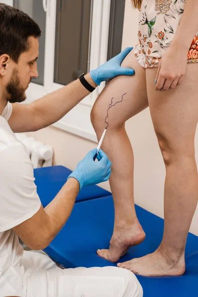 The phlebologist is marking legs before surgery to remove the veins. The vascular surgeon is marking leg veins. Vein markup