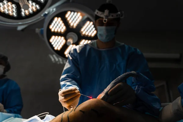 Vascular surgeon is operating leg using EVLT Red laser optical fiber for endovenous laser coagulation for treatment varicose veins, thrombophlebitis, thrombosis of legs in operating room