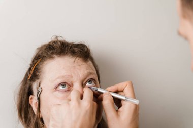 Tıbbi klinikteki yüz bölgesinin estetik cerrahi operasyonundan önce yüz üzerinde Blepharoplasty izi var.