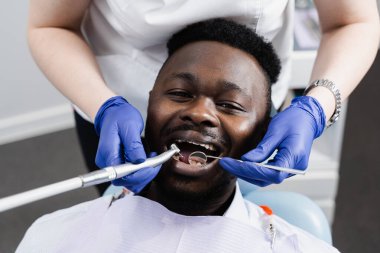 Dişçi, dişçilik kliniğinde dişçilik yapıyor ve Afrikalı bir adamın karnını temizliyor. Diş tedavisi. Afrikalı Amerikalı hasta için diş dolgusu.