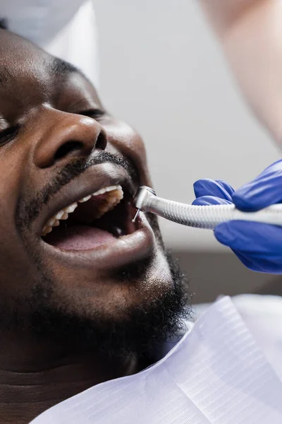 Dental drill close-up. Dentist drilling teeth of african man in dentistry clinic. Teeth treatment. Dental filling for african american man patient