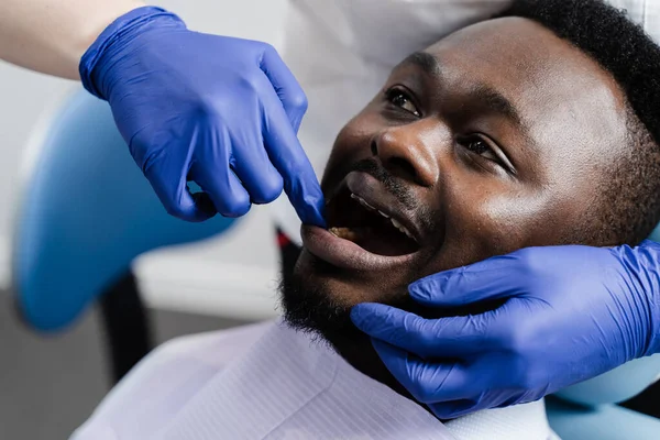 African american man with toothache on consultation and treatment at the dentist in stomatology. Dentist treats caries teeth for african man