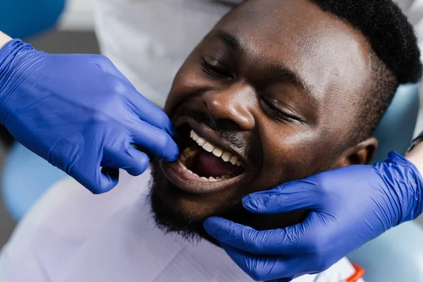 Dentist examines teeth and mouth of african man with blue gloved hands. Dentist touches patient teeth with his hands in dentistry