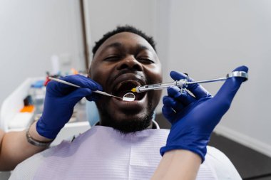 Dişçi Afrikalı hastaya hastalıklı dişlerin anestezi şırıngasını enjekte ediyor. Karne tedavisi