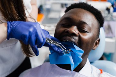 Stomatolojide dişleri tedavi etmek için Afrikalı bir adamın çenesine diş macunu yerleştirme işlemi. Diş izolasyonu için diş barajı kullanan bir dişçi.