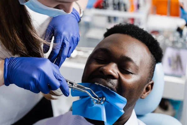 Dentist placing cofferdam in jaw of african man for treatment teeth in stomatology. Dentist using dental dam for tooth isolation