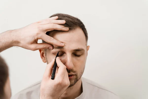 Male Blepharoplasty Man Markup Plastic Surgeon Draws Markings Eyelid Plastic — Stock Photo, Image