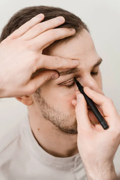 stock image Close-up male blepharoplasty for man markup on the face before plastic surgery operation for modifying the eye region in medical clinic