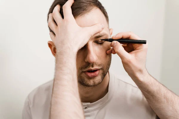 stock image Blepharoplasty for man markup on the face before plastic surgery operation for modifying the eye region in medical clinic