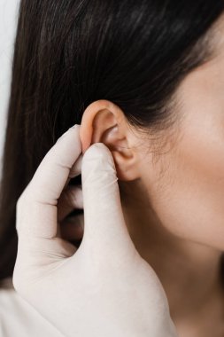 Kulak ameliyatı. Yakın plan. Doktor otoplasti estetik ameliyatından önce kız kulaklarını muayene ediyor. Kulak ve Pinna cerrahi yeniden şekillendirme