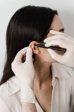 Ameliyat doktoru otoplasti estetik ameliyatından önce kızın kulağını işaretliyor. Pinna cerrahi yeniden şekillendirme için Otoplasty işaretleme, ya da düzensizlik düzeltmek ve görünümünü iyileştirmek için dış kulak